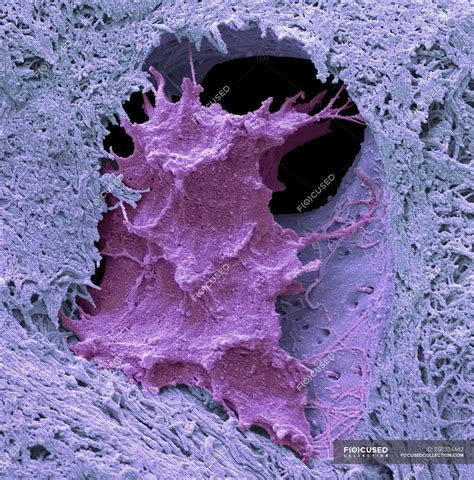 Coloured Scanning Electron Micrograph Of Osteocyte Bone Cell Surrounded