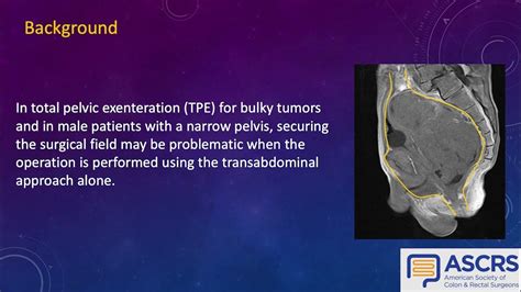 Transanal Minimally Invasive Surgical Approach To Total Pelvic