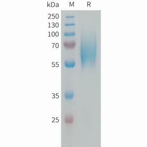 Human FGFR2 Protein NewEast Biosciences GTPase Oncogene And