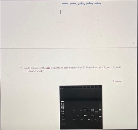 Solved Polymerase Chain Reaction 1. Upload a labelled image | Chegg.com