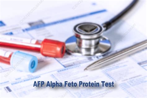 Alpha feto protein test, conceptual image - Stock Image - F037/1104 ...