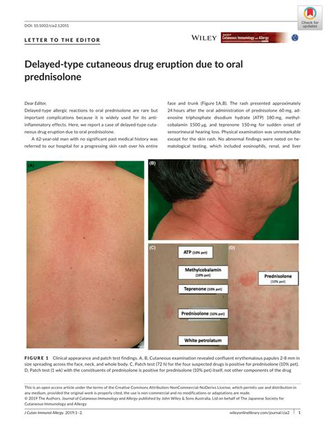 Pdf Delayed‐type Cutaneous Drug Eruption Due To Oral Prednisolone