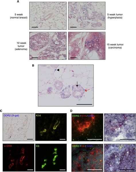 Ddr Expression In Mouse Mmtv Pymt Breast Tumor Development And