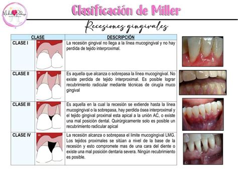 Periodoncia Udocz