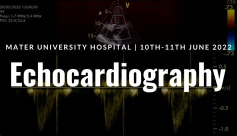 Introduction To Echocardiography Workshop The Pillar Centre The