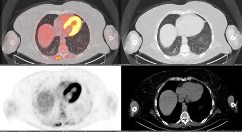 Introduction To Pet Ct