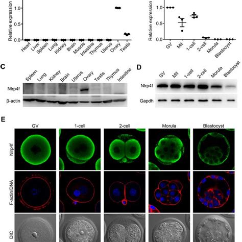 Formation Of Cpls And Scmc In Mouse Oocytes A Tem Images Of Gv