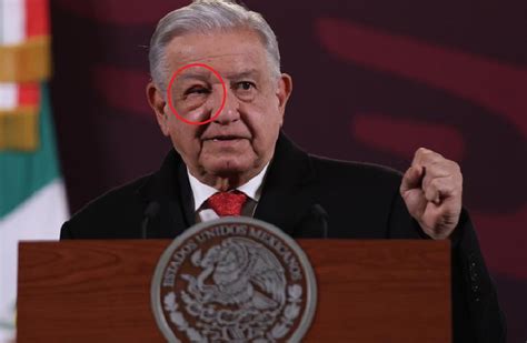 Qu Le Pas A Amlo En El Ojo