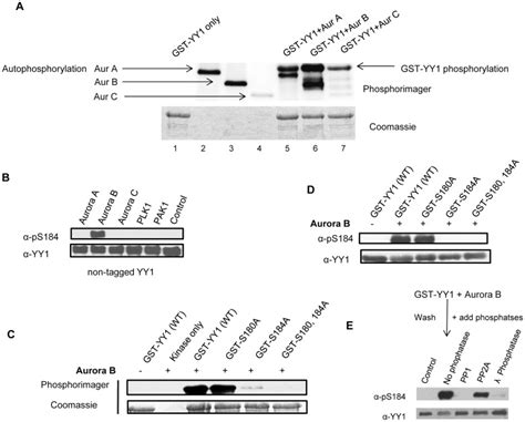 A Radioactive In Vitro Kinase Assay Using Purified Aurora Kinase