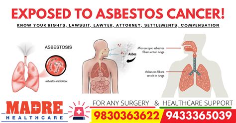 Asbestos Cancer Lawsuit Lawyer Attorney Settlements Compensation