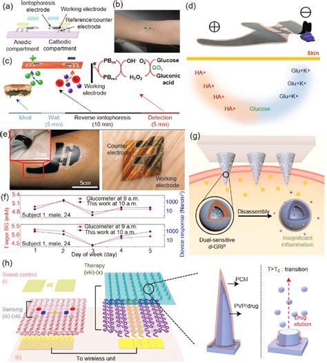 Extended Noninvasive Glucose Monitoring In The Interstitial Off