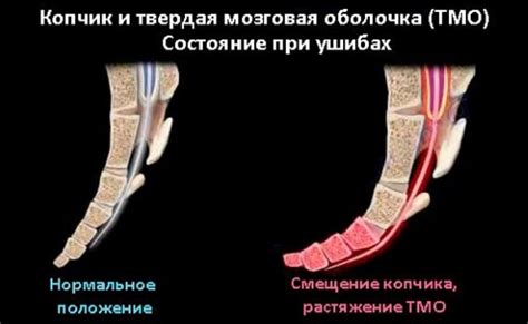 Боль в копчике у мужчин при воспалении и переломе: симптомы ...