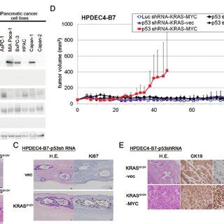 Expression Of Hpv E E Kras G V And Myc T A Is Sufficient For Full