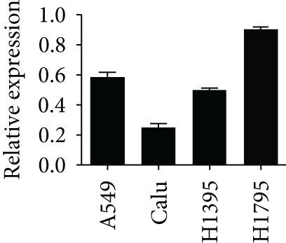 FAM83Apromoted Proliferation Of LUAD Cells A B Western Blotting