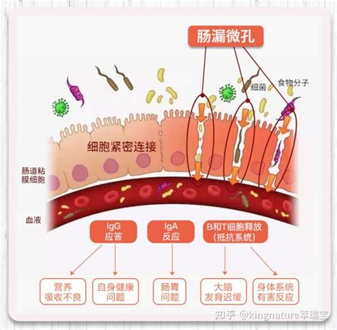 为什么肠漏是“百病之源” 知乎