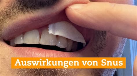 Gesundheitliche Auswirkungen Von Snus YouTube