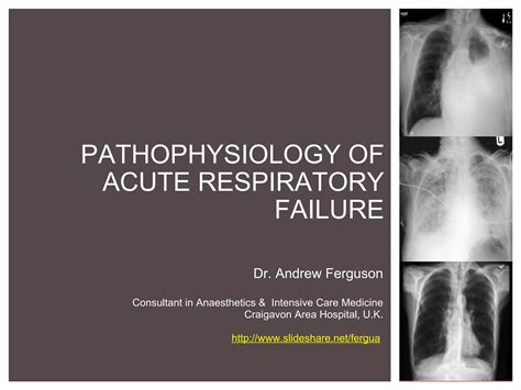 Pathophysiology Of Hypoxic Respiratory Failure Ppt