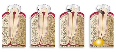 Odontoiatria Conservativa Settimo Milanese Studio Dentistico My Smile