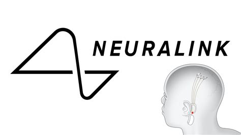 Neuralink human trials: Are we ready for brain-fitted AI?