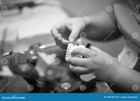 The Process of Manufacturing Dentures Stock Image - Image of clinical ...