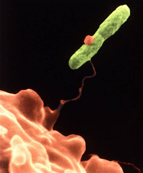 An Amoeba Hartmannella Vermiformis Orange Entraps A Legionella