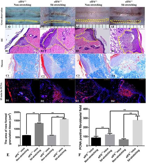 Histology Of Newly Formed Granulation Tissue In Partial Thickness