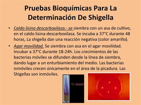 Ppt Shigella Powerpoint Presentation Free Download Id2354142