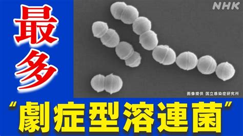 「劇症型溶血性レンサ球菌感染症」ことしの患者数 過去最多に Nhk