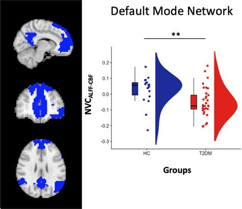 Frontiers Neurovascular Coupling In Patients With Type Diabetes