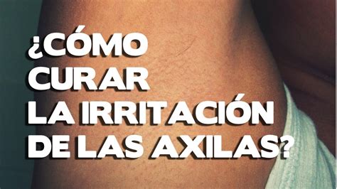 Como Cuarar La Irritacion De Las Axilas Causas Y Remedios Para Aliviar