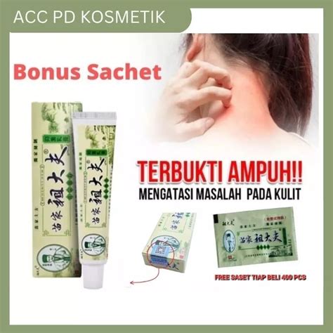 Jual ORIGINAL SALEP GATAL ZUDAIFU OBAT GATEL EKSIM JAMUR ALERGI