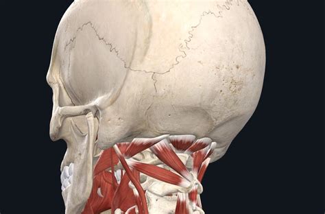 Suboccipital Muscles and Headaches - PhysioStrength