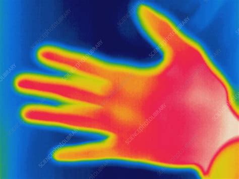 Thermogram Of Human Hand Stock Image H Science Photo Library