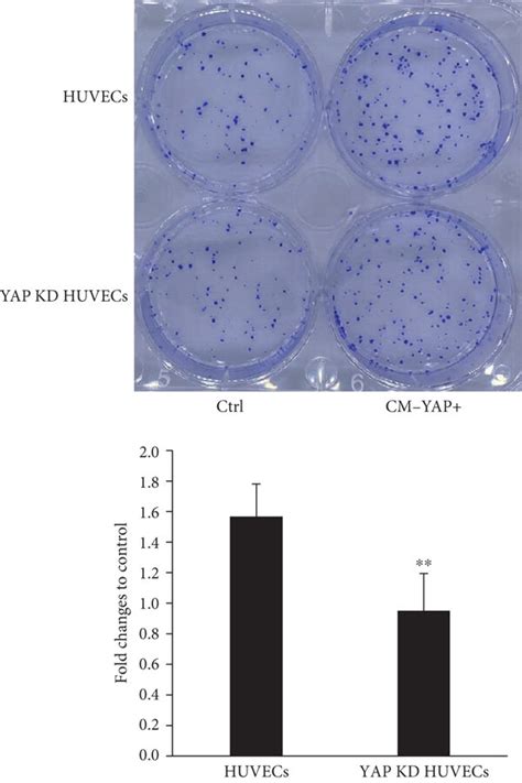 Yap Expression In Huvecs Involved In Mediating Cm Yap Induced Tube