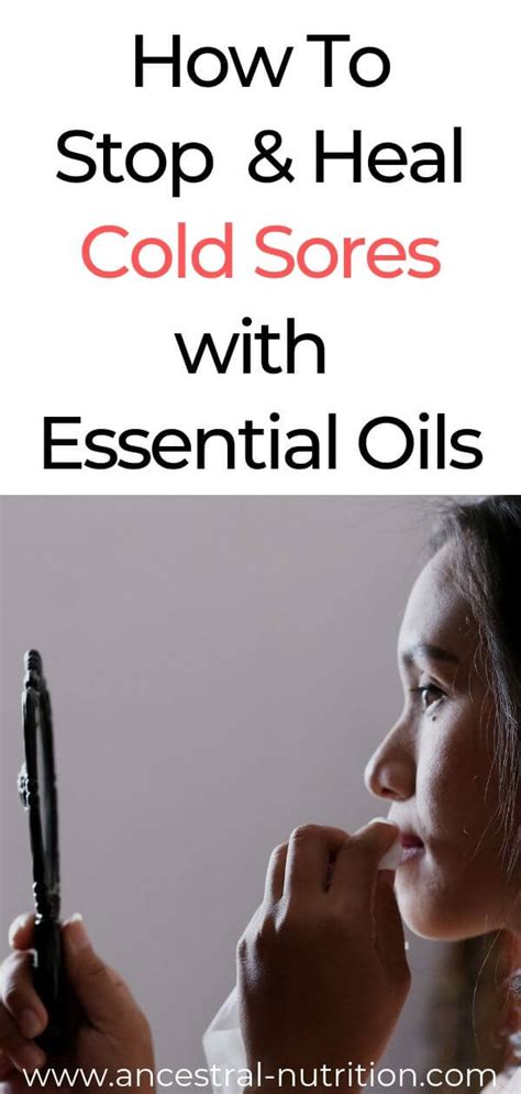 How To Stop And Heal Cold Sores With Essential Oils Ancestral Nutrition