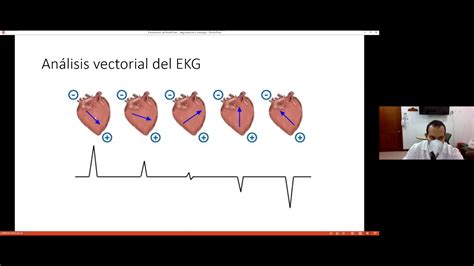 Electrocardiografía Integrada A Fisiología Y Anatomía Youtube