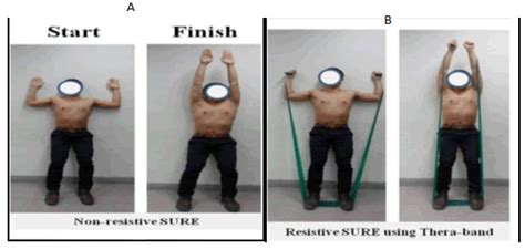 Effect Of Scapular Upward Rotation Exercises On Brachial Plexus