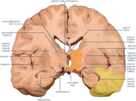 Posterior Brain