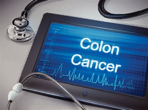 3 Types Of Colon Cancer Screening Tests Where