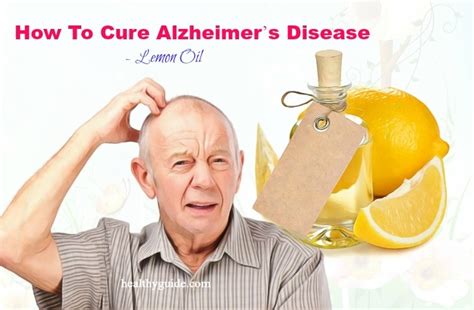 Top 24 Tips How To Cure Alzheimers Disease Fast And Naturally At Home