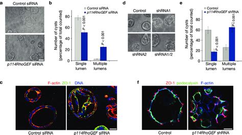 P114rhogef Regulates Epithelial Morphogenesis In Three Dimensional Download Scientific Diagram