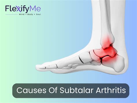 Understanding Subtalar Arthritis and Possible Solutions