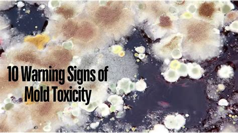 10 Warning Signs Of Mold Toxicity Health Alert