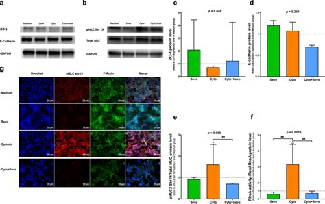 Effects Of Sevoflurane On Junction Proteins And Rhoa Pmlc F Actin