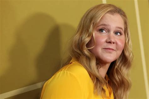 Amy Schumer Se Abre Sobre Su “rostro Hinchado” Y El Síndrome De Cushing