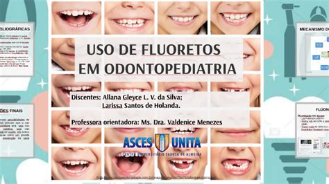 Uso De Fluoretos Em Odontopediatria By Allana Ver Ssimo On Prezi