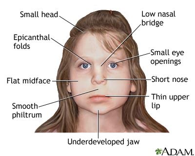 Congenital Anomalies Lecture Flashcards Quizlet