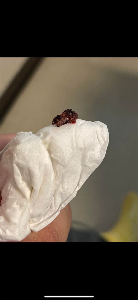 Pulled This Solid Chunk Outta My Nose Boogers