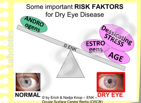 GLIMPSE On Dry Eye Disease Ocular Surface Center Berlin