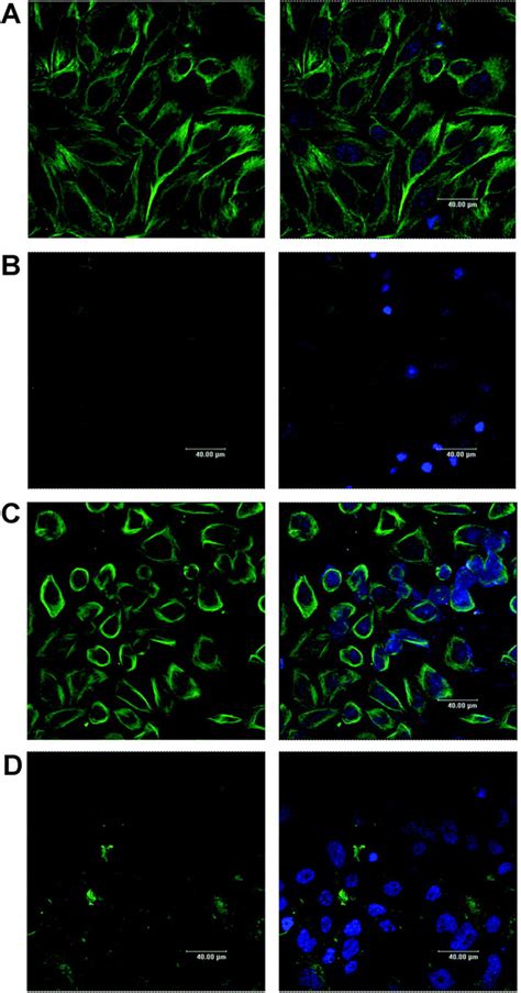 Cil 102 Interacts With Microtubule Polymerization And Causes Mitotic